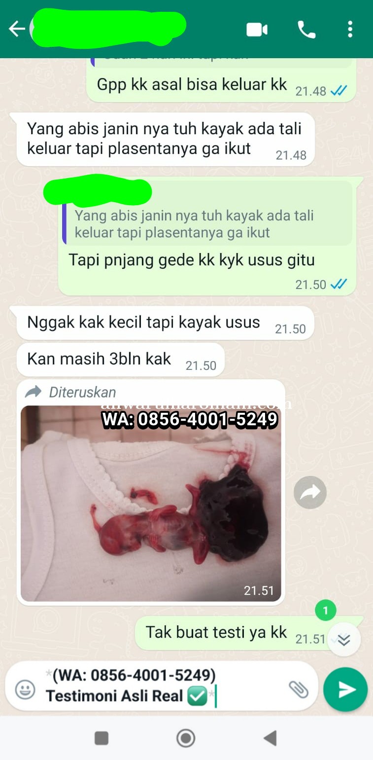 jual obat cytotec Di Ciamis wa 085640015249 klinik aborsi asli Dosis 200mg Sampai 400mg Terpercaya 