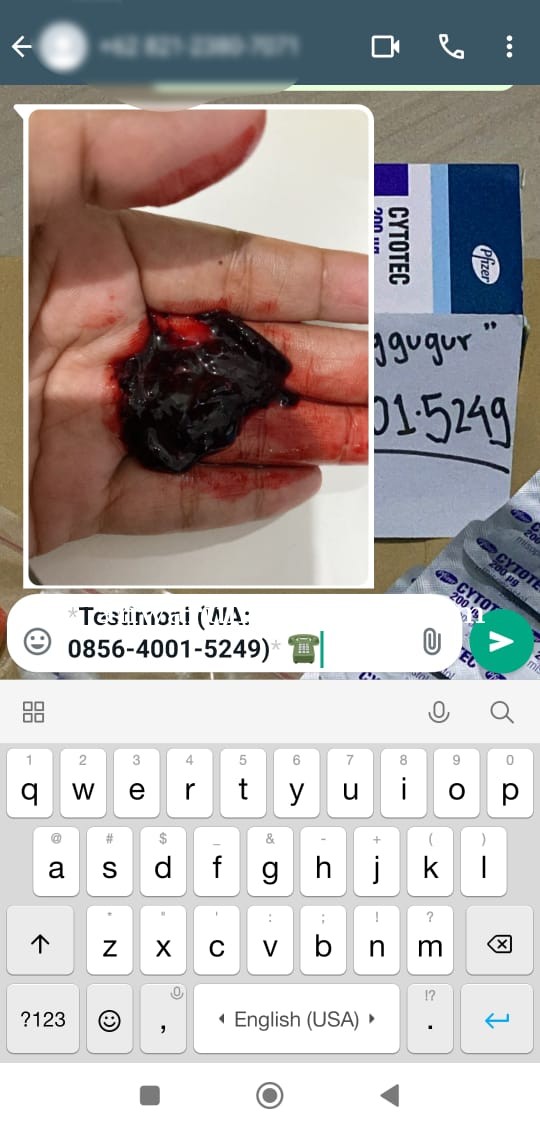 jual obat cytotec 085640015249 obat aborsi penggugur kandungan di Mayong 200mg sampai 400mg tersedia
