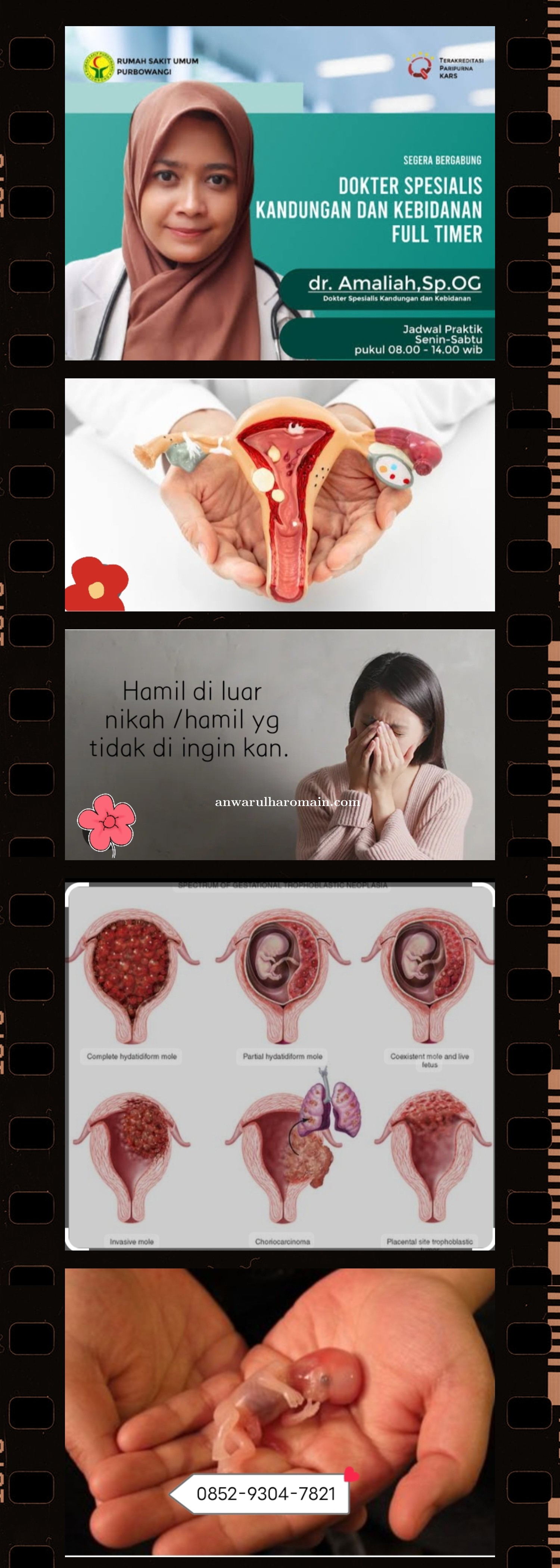 Wa085951663000 Apotik Jual Obat Aborsi Cytotec Di Sibolga